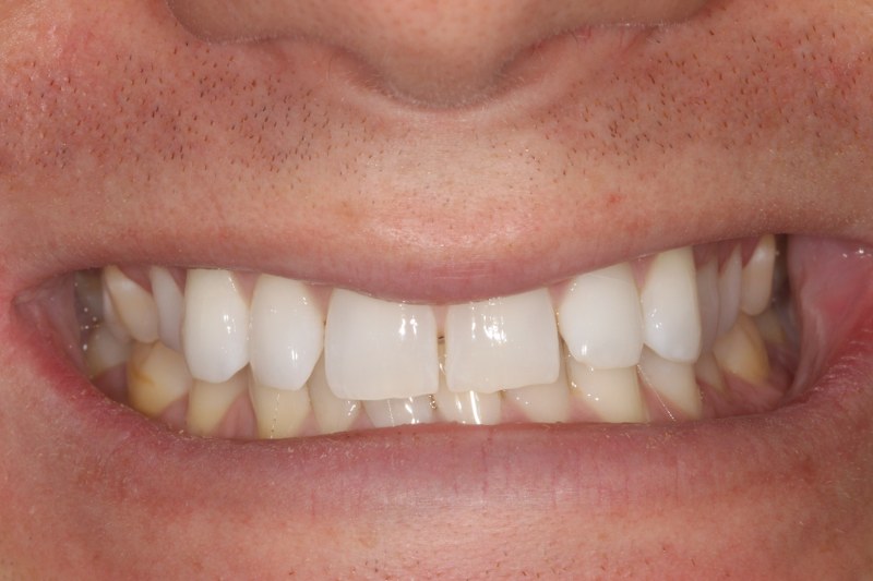 Before - Cheadle Hulme Dental