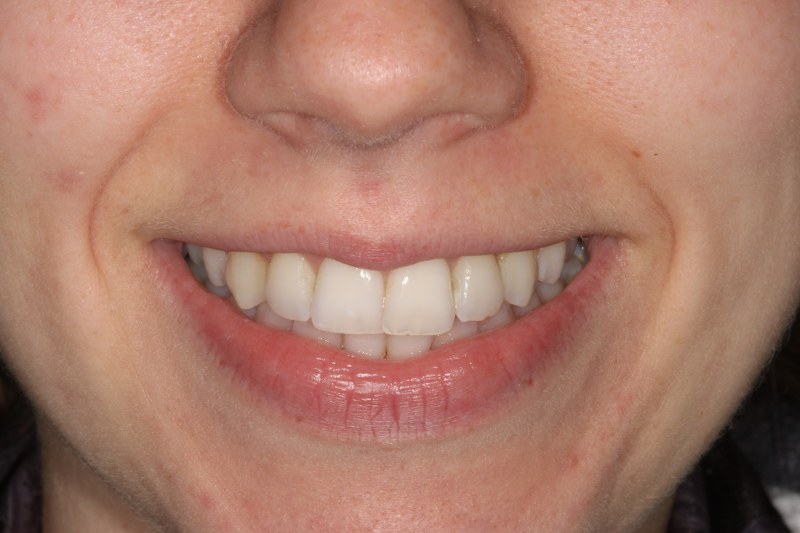 Before - Cheadle Hulme Dental