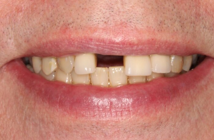 Before - Cheadle Hulme Dental