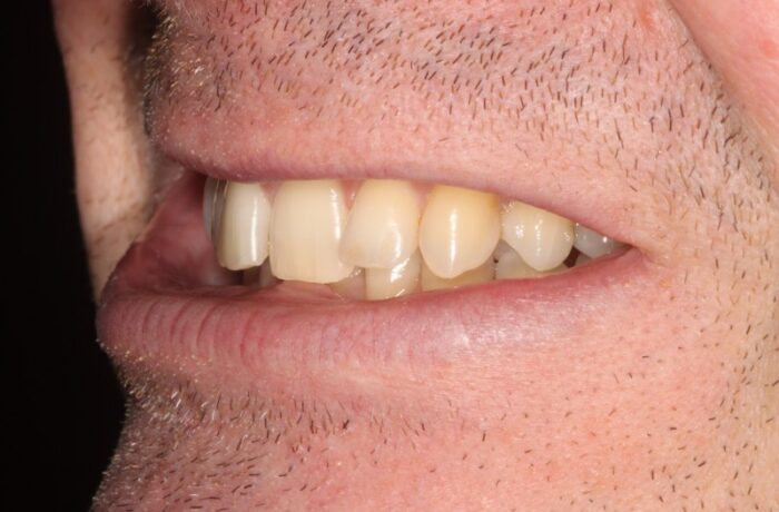 Before - Cheadle Hulme Dental