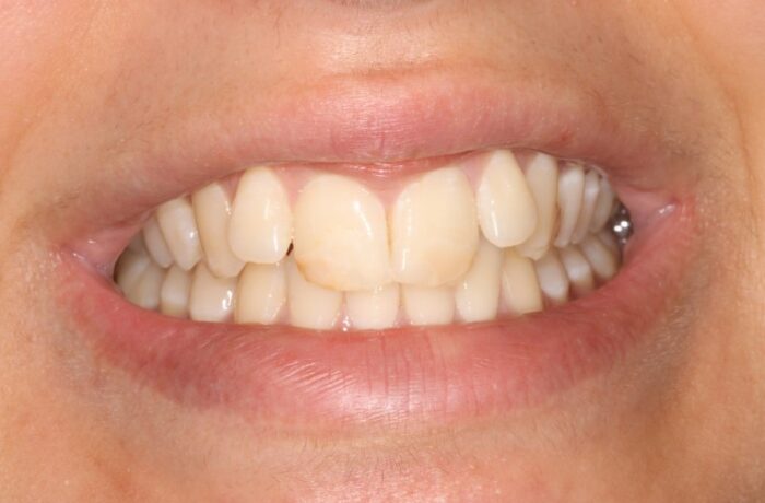 Before - Cheadle Hulme Dental