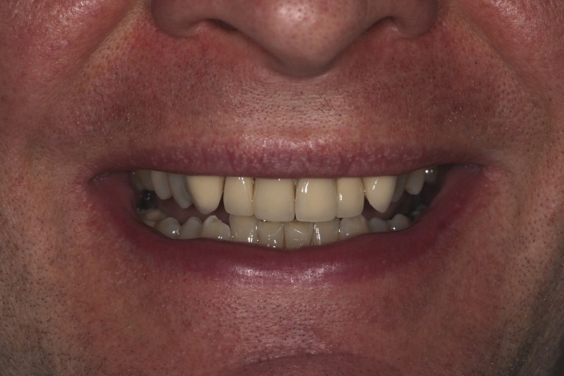 Before - Cheadle Hulme Dental