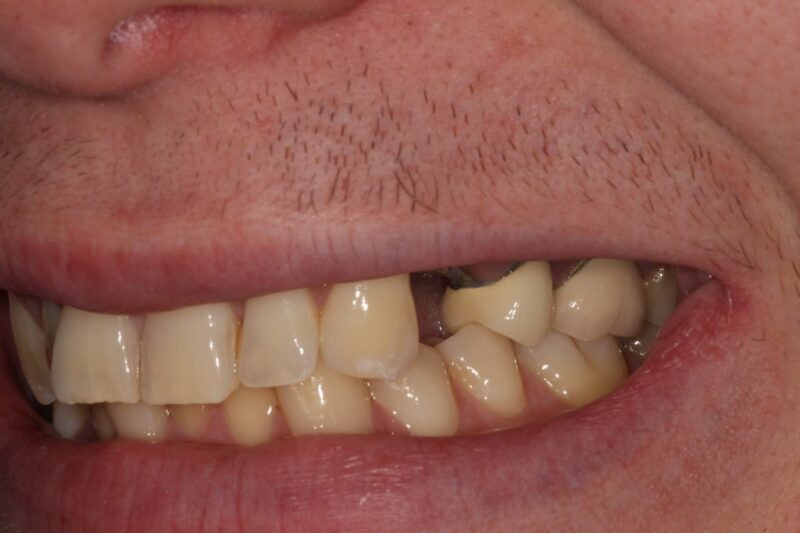 Before - Cheadle Hulme Dental