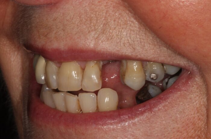 Before - Cheadle Hulme Dental