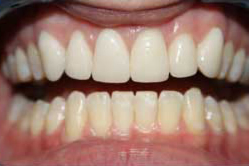 After - Cheadle Hulme Dental