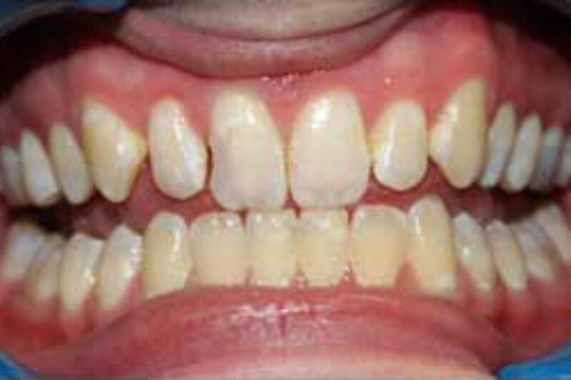 Before - Cheadle Hulme Dental