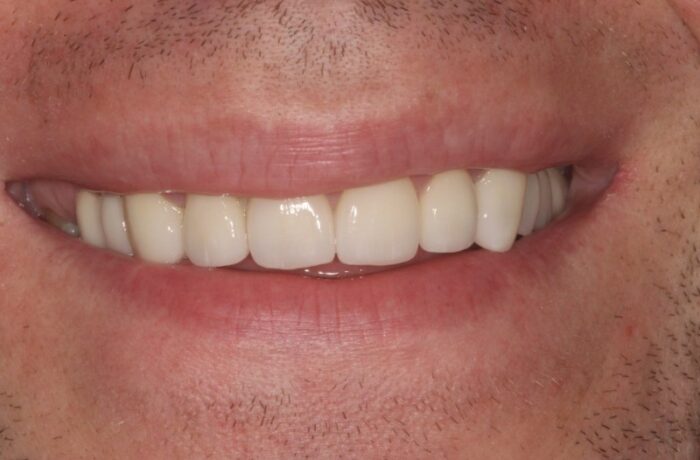 After - Cheadle Hulme Dental