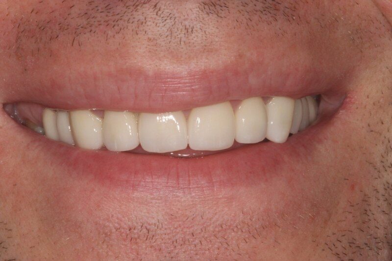 After - Cheadle Hulme Dental