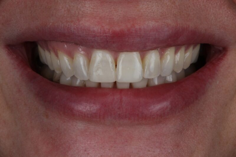 After - Cheadle Hulme Dental