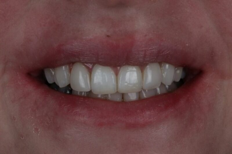 After - Cheadle Hulme Dental