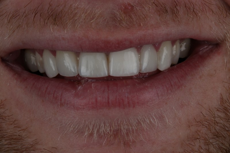 After - Cheadle Hulme Dental