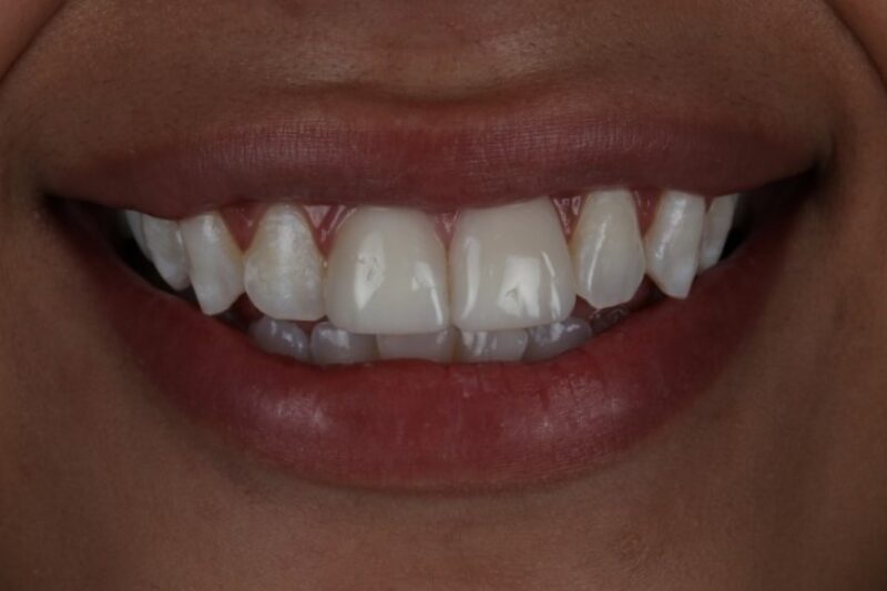 After - Cheadle Hulme Dental