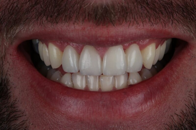 After - Cheadle Hulme Dental