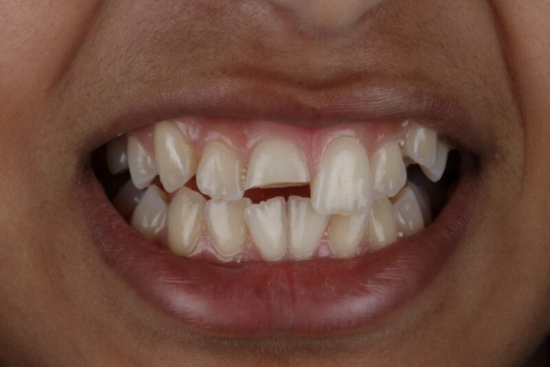 Before - Cheadle Hulme Dental