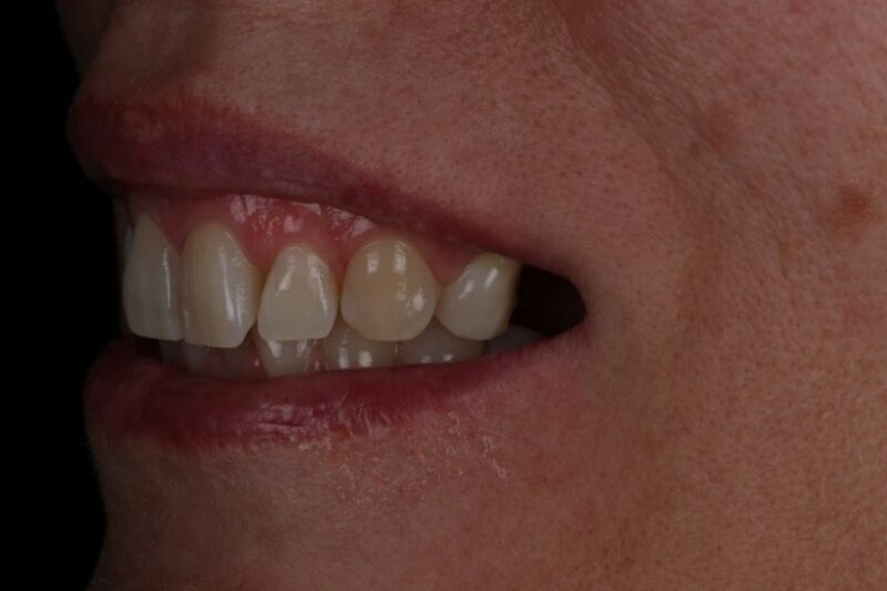 Before - Cheadle Hulme Dental