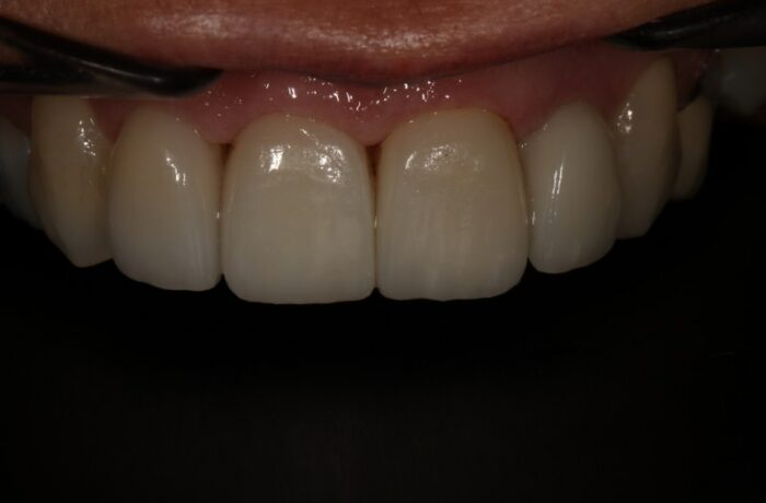 After - Cheadle Hulme Dental