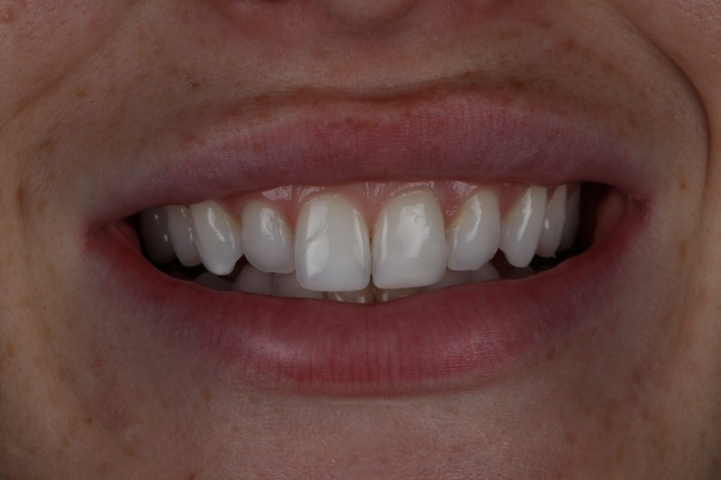 After - Cheadle Hulme Dental