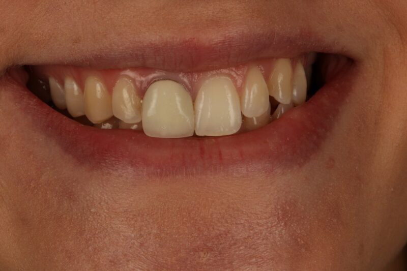 Before - Cheadle Hulme Dental