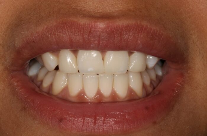 After - Cheadle Hulme Dental