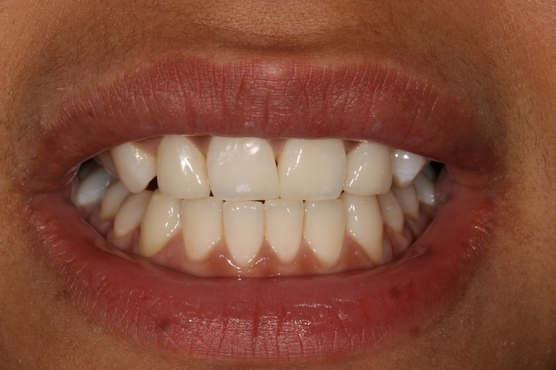 After - Cheadle Hulme Dental