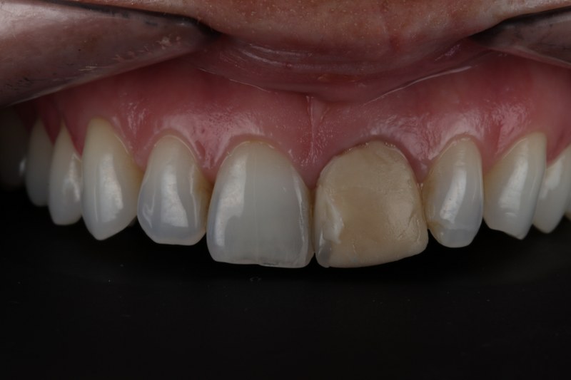 Before - Cheadle Hulme Dental