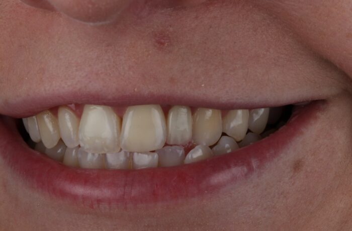 After - Cheadle Hulme Dental