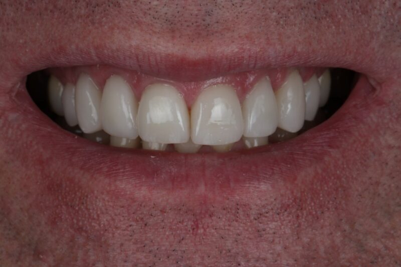 After - Cheadle Hulme Dental