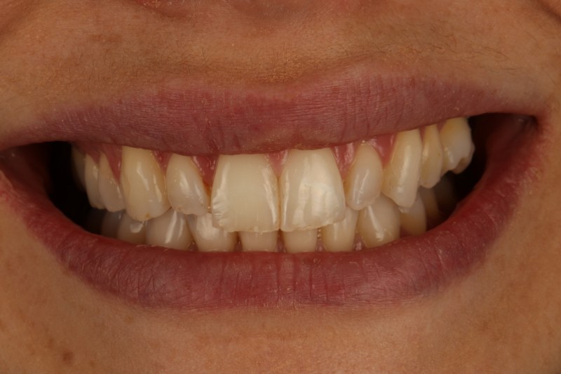 Before - Cheadle Hulme Dental