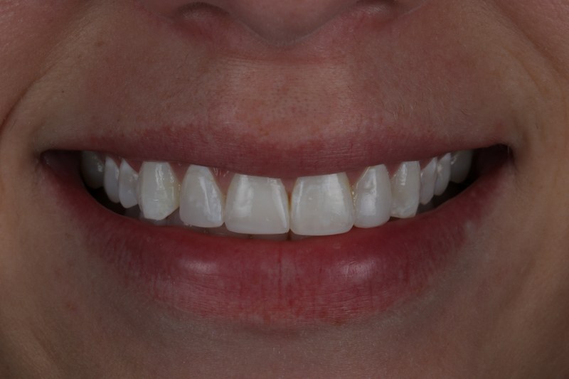 After - Cheadle Hulme Dental