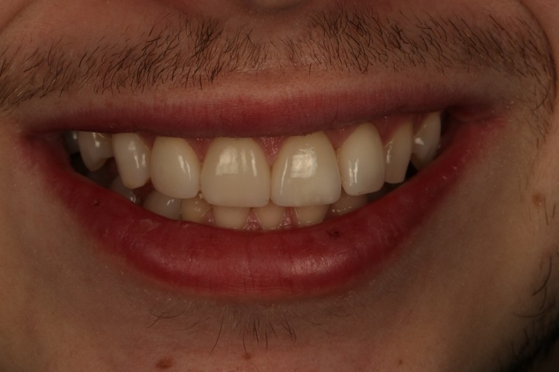 After - Cheadle Hulme Dental