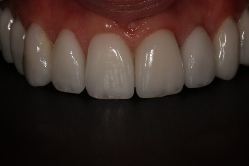 After - Cheadle Hulme Dental