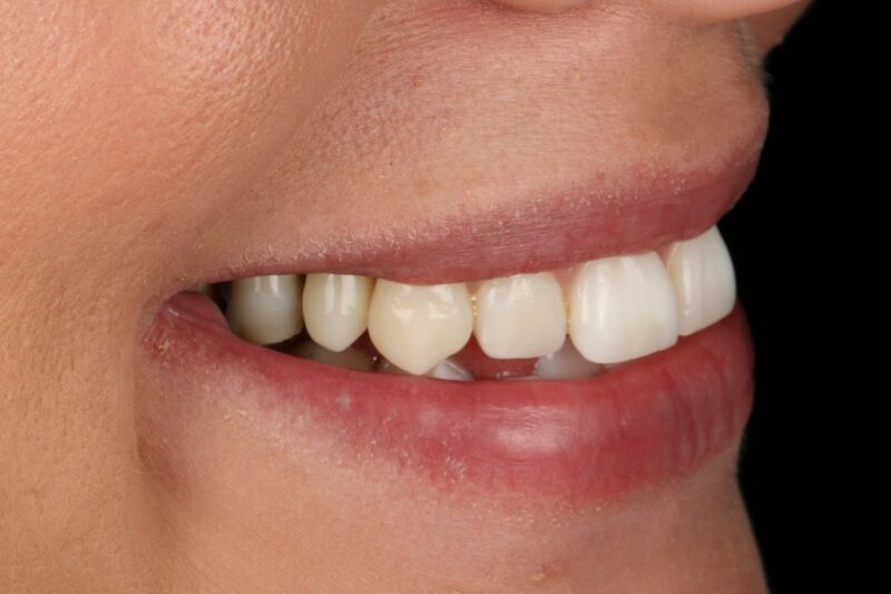 After - Cheadle Hulme Dental