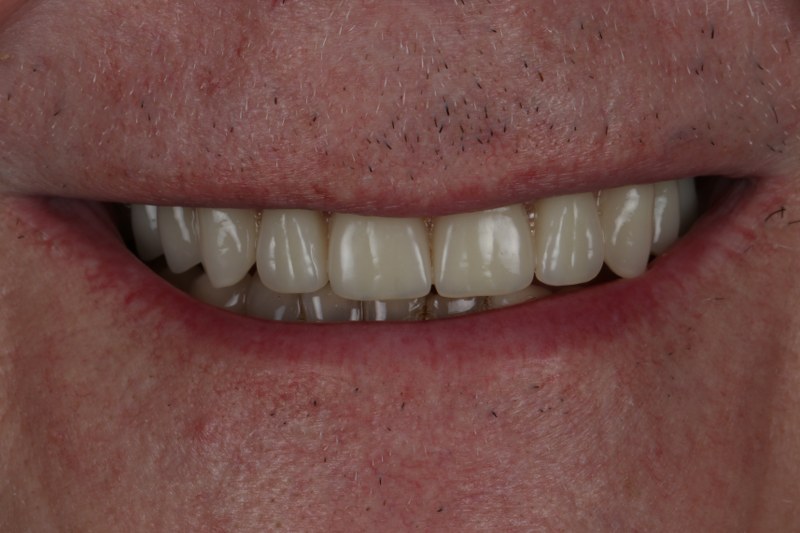 After - Cheadle Hulme Dental