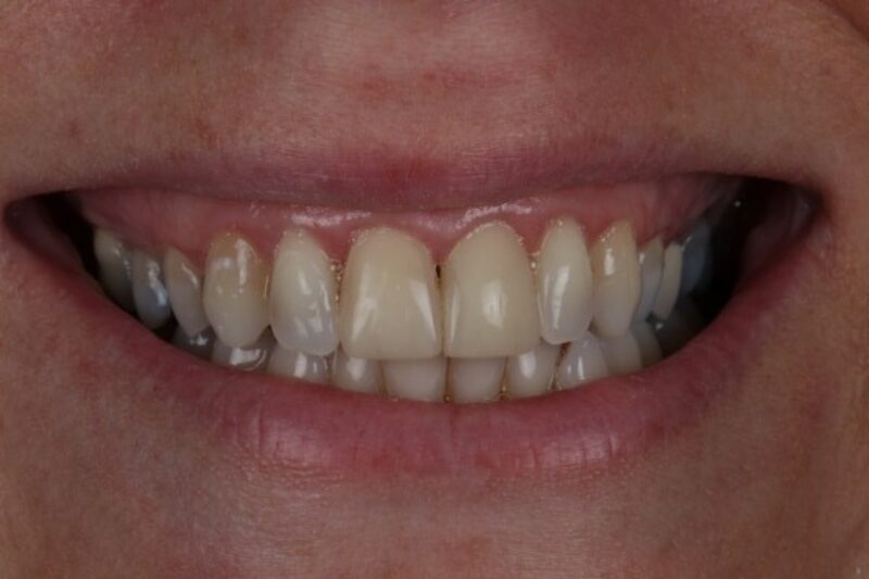 After - Cheadle Hulme Dental