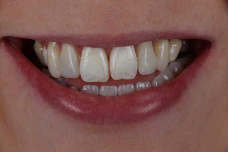 After - Cheadle Hulme Dental