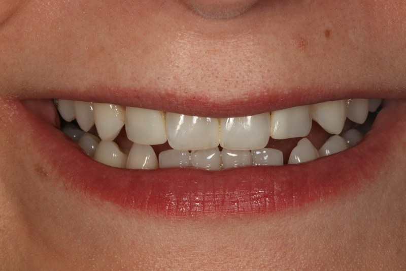 After - Cheadle Hulme Dental