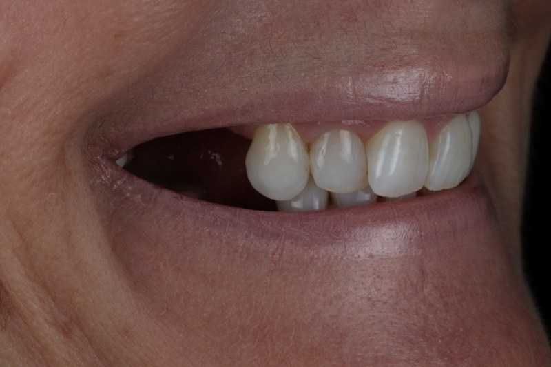 Before - Cheadle Hulme Dental