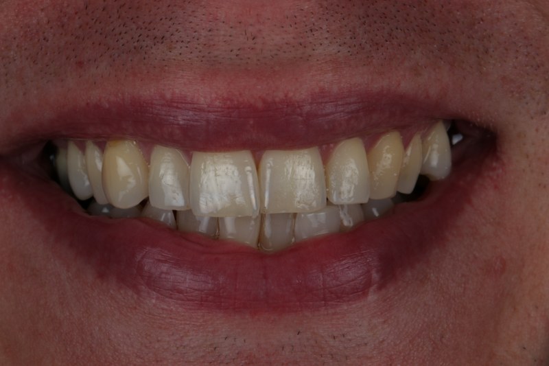 Before - Cheadle Hulme Dental