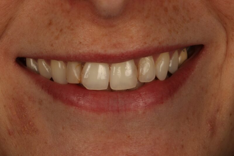 Before - Cheadle Hulme Dental