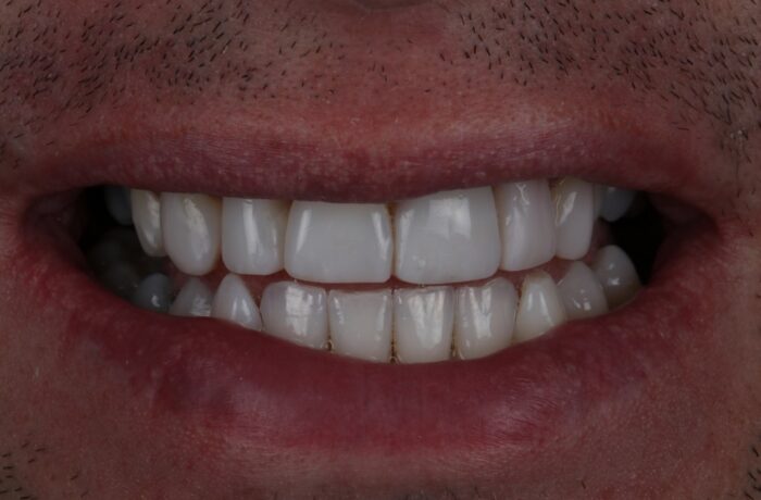 After - Cheadle Hulme Dental