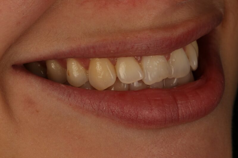 Before - Cheadle Hulme Dental