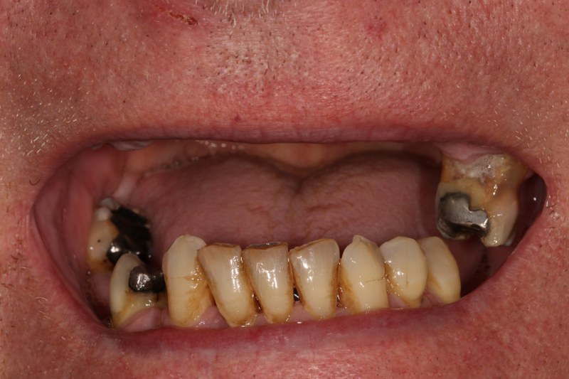 Before - Cheadle Hulme Dental