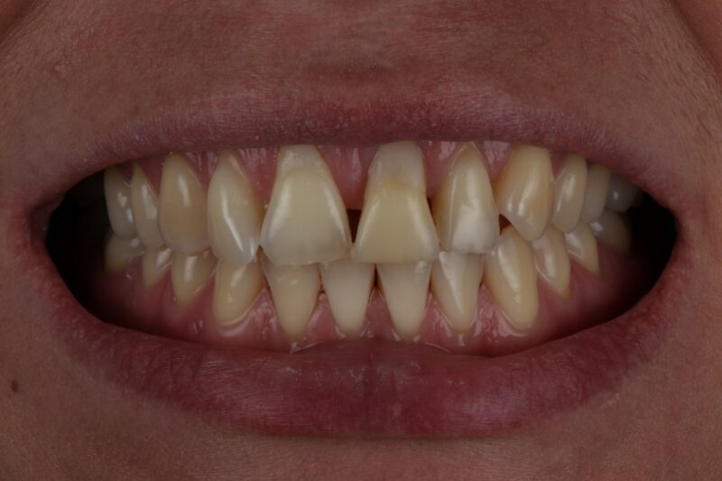 Before - Cheadle Hulme Dental