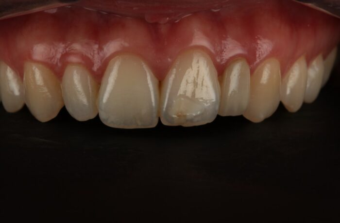 Before - Cheadle Hulme Dental