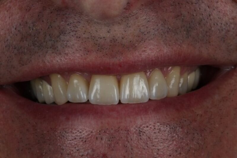 After - Cheadle Hulme Dental