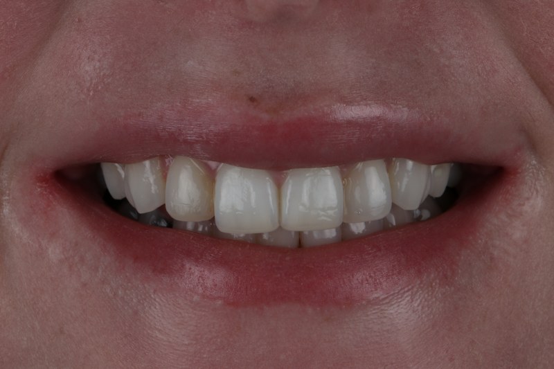 Before - Cheadle Hulme Dental