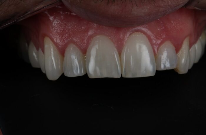 Before - Cheadle Hulme Dental