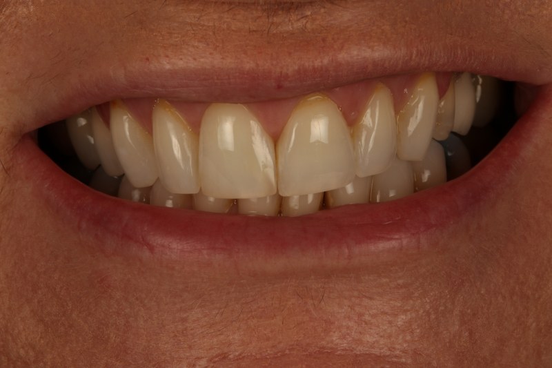 Before - Cheadle Hulme Dental