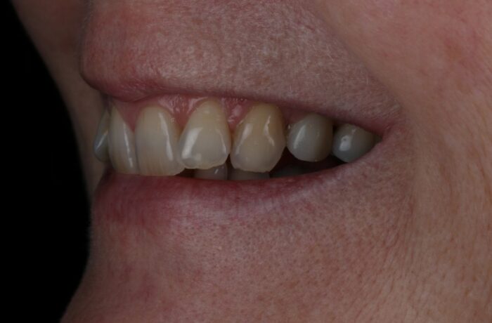 After - Cheadle Hulme Dental