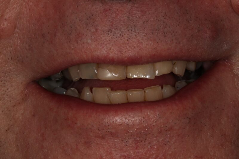 After - Cheadle Hulme Dental